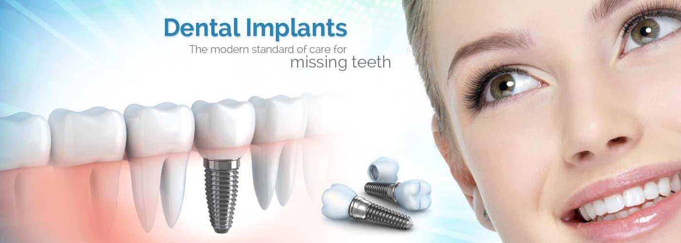 Dental Implant Dentist near me