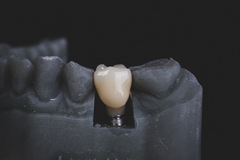 Dental Crowns