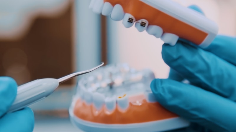 LANAP laser gum treatment procedure at Fort Worth Dental Texas